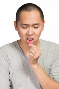 Fever Blisters, Cold Sores, Canker Sores